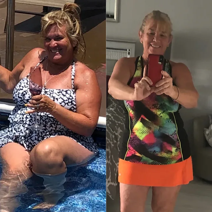 SodaSlim before and after result